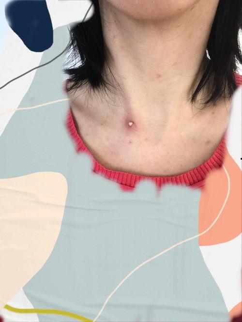 明星之间长疖子,长疖子背后的护肤真相